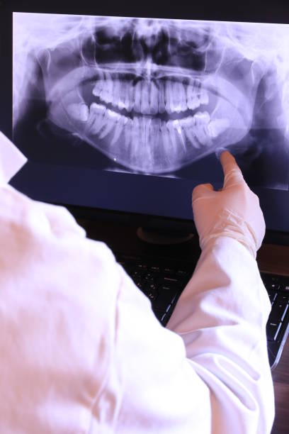 Best Dental Abscess Treatment in Lowes Island, VA